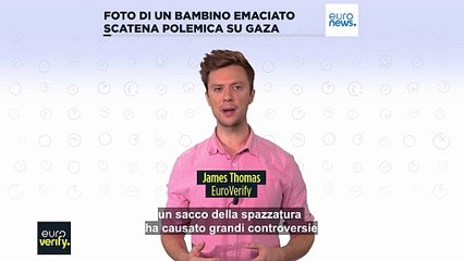 Gaza: polemiche per la foto del bimbo malato e denutrito pubblicata dal New York Times