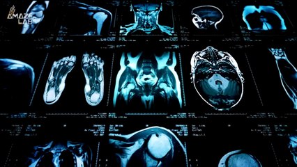 Looking at the Brain and the Heart at the Same Time Is Now Possible!