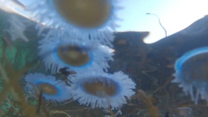 여름철 불청객 해파리 등장...예방·대처법은? / YTN