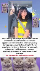 28‑year‑old Malaysian woman who bravely shared her dramatic appearance transformation