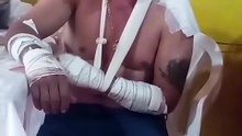 Homem afirma que foi atacado por onça