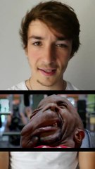 Maladie Étrange : Symptômes et Causes