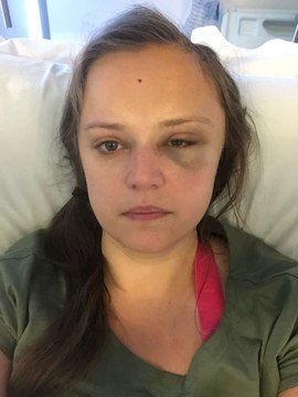 Woman diagnosed with brain tumour after confusion mistaken for panic attacks