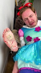 The Most Satisfying Dead Skin Removal Ever! 🤯✨