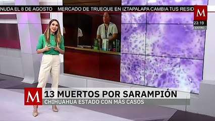 Sarampión deja 13 muertos y más de 3500 contagios en Chihuahua según autoridades