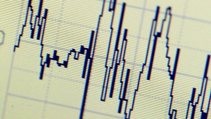 “Pacemakers Over 60 What No One Tells You (Until It's In Your Chest)”