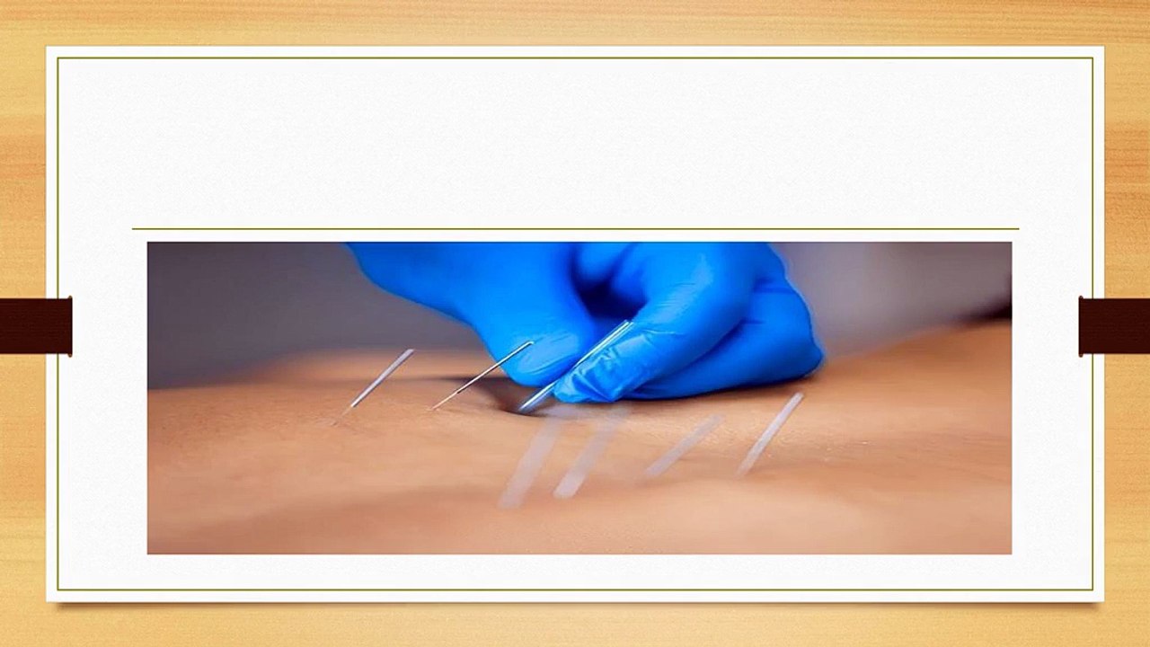 Why in Dry Needling Downtown Toronto Beats Pain Meds Fast?