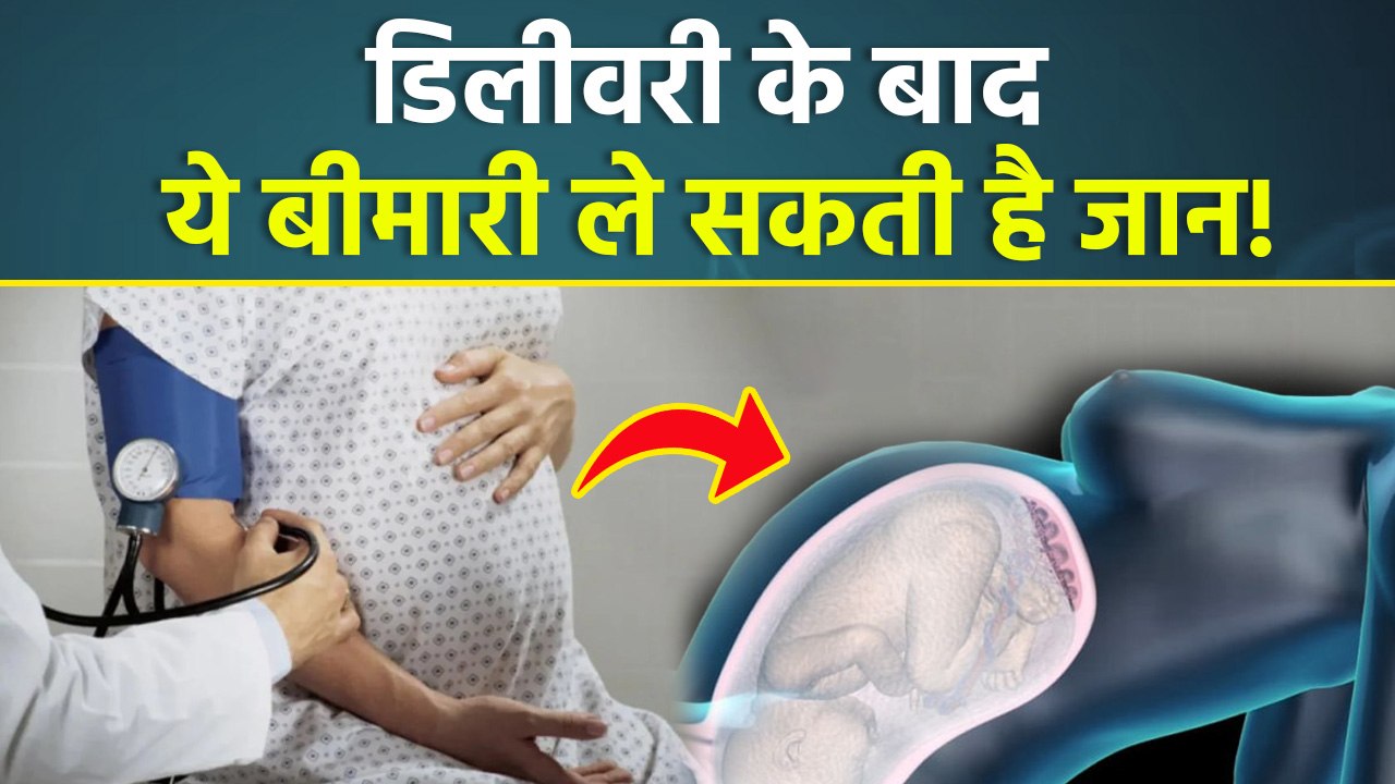 Delivery Ke Baad Preeclampsia kyu Hota Hai,Treatment In Hindi | Boldsky