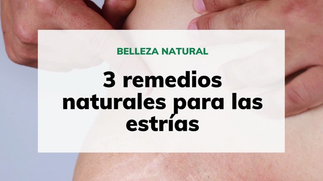 3 remedios naturales para las estrías