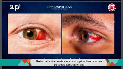 SLP Jueves 7 de agosto entrevista 1