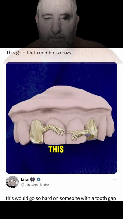 Tooth Gap Reaction
