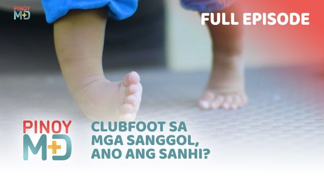Clubfoot sa mga sanggol, ano ang sanhi? (Full Episode) | Pinoy MD