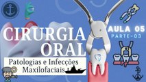 Cirurgia III /// AULA 05 - Patologias e Infecções Maxilofaciais - Marinha - Odontologia