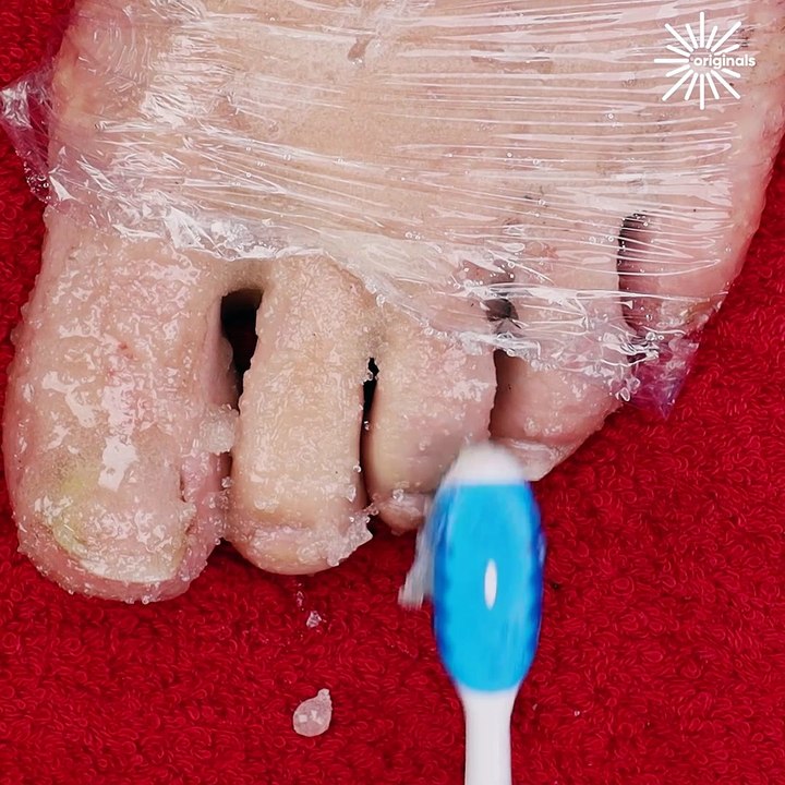 Toe-tal transformation: pedicure magic 👣✨