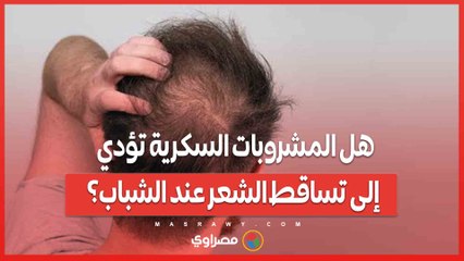 هل المشروبات السكرية تؤدي إلى تساقط الشعر عند الشباب؟