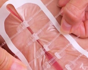 So That’s How They Do It! Medical Procedures Explained