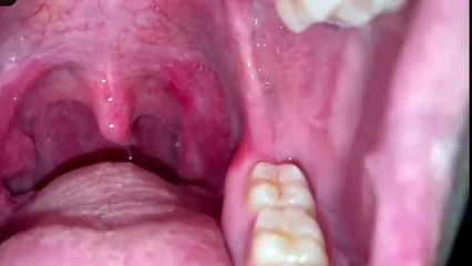 masstiktok_www.tiktok.coco06__##lipglossssssssss #coco #Tongue #oral #randomasmr #fypシviralvideo #fypシtiktoktrending #smoothlips #tiktokcreators