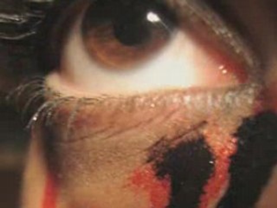 eyes