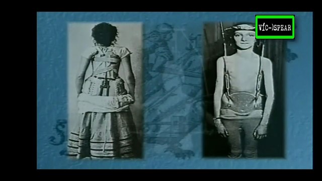 La Naturaleza de las Cosas: Escoliosis, opción de riesgo - Documental (1999)