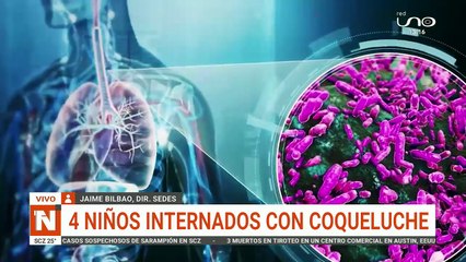 Notivision medio día 12/08/2025