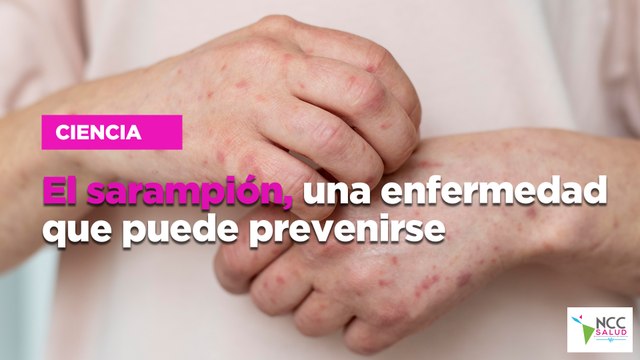 El sarampión, una enfermedad que puede prevenirse