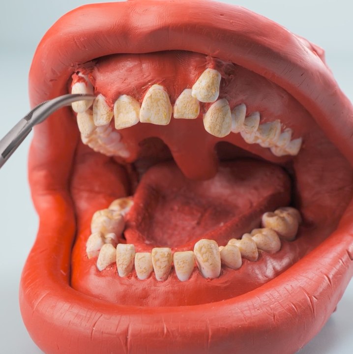 Les raisons surprenantes qui expliquent les moindres faits et gestes de votre dentiste !