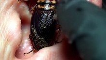 Scary!!!!!!!!!!   Cockroach earwax removal 😲😲  #earwax #satisfyling