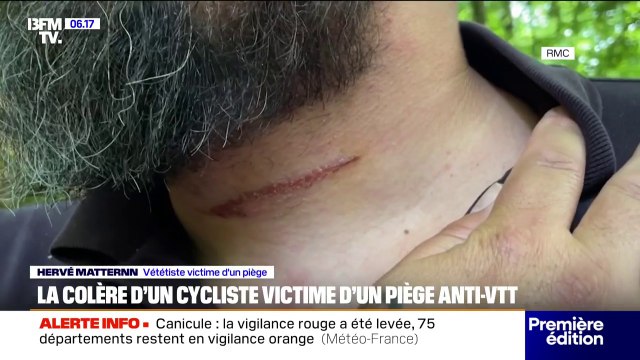 Un cycliste victime d'un piège anti-VTT dans le massif des Vosges
