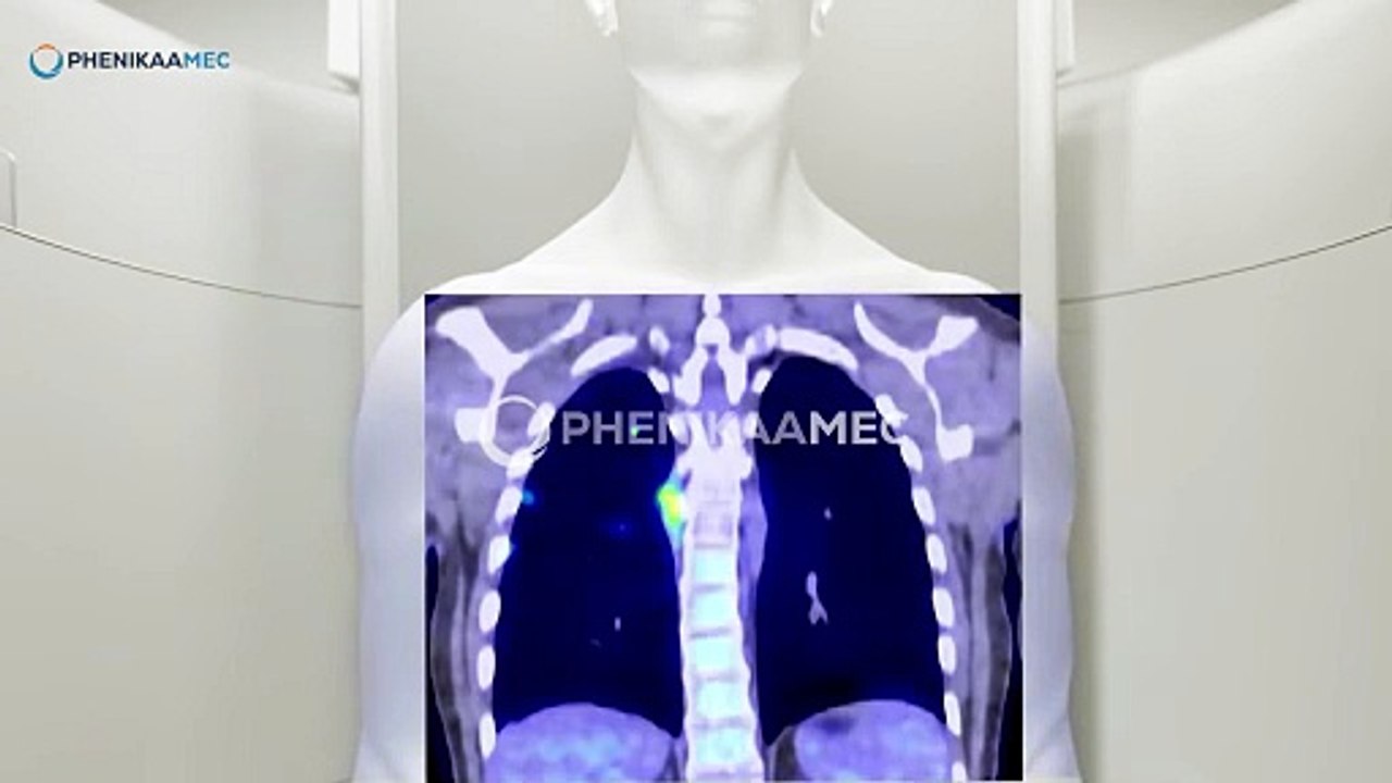 Thực hiện tầm soát ung thư tại Bệnh viện Đại học Phenikaa