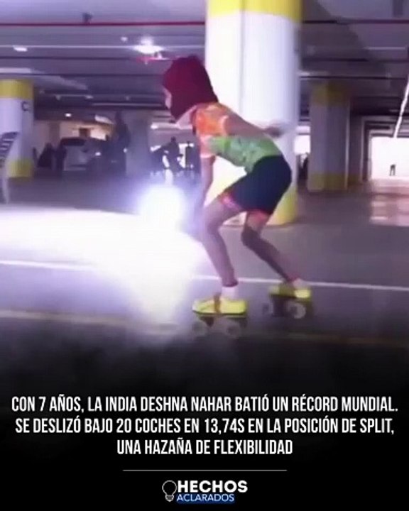 NIÑA DE 7 AÑOS SPLIT