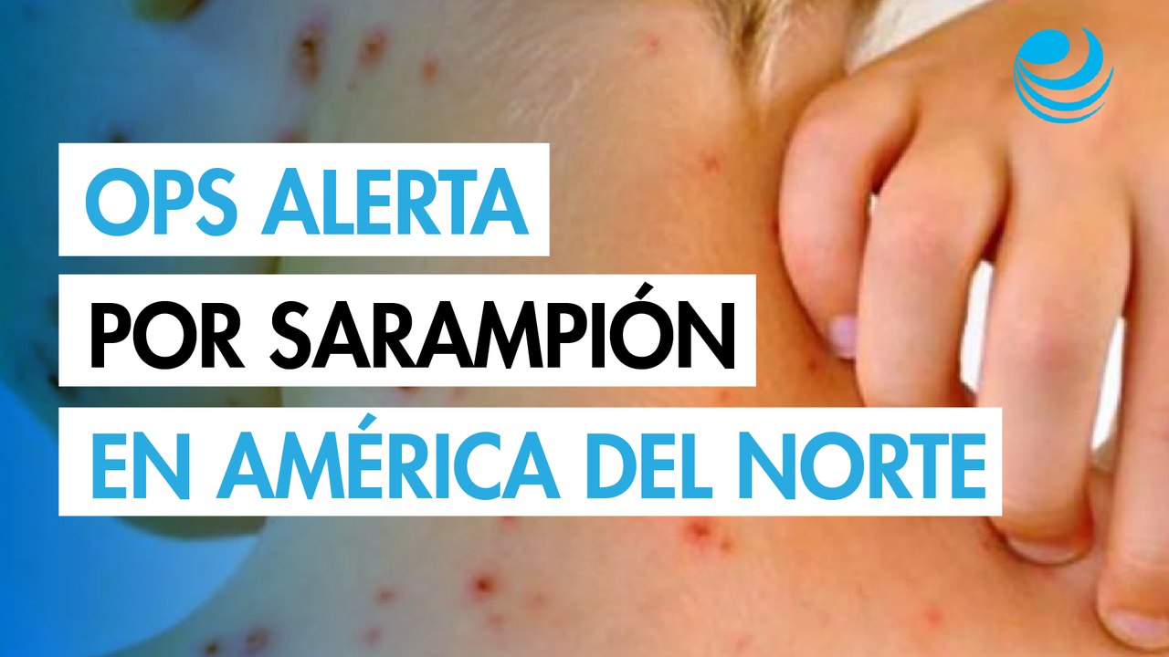 Brote de sarampión en América del Norte: OPS al...