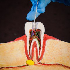 Simulation Explains How Operations Really Work