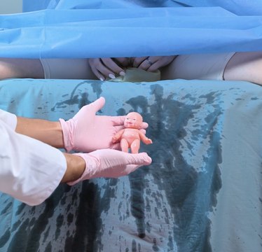 A Closer Look at the Surgical Process: What Happens in the Operating Room