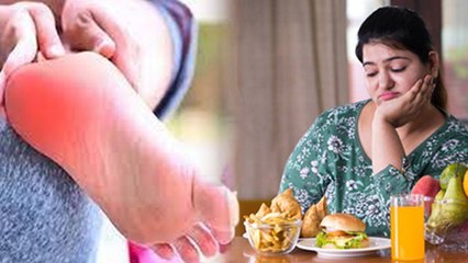 High Uric Acid Arthritis Me Kya Khana Chahiye, Food To Eat & Avoid, Full Diet Plan...|Boldsky