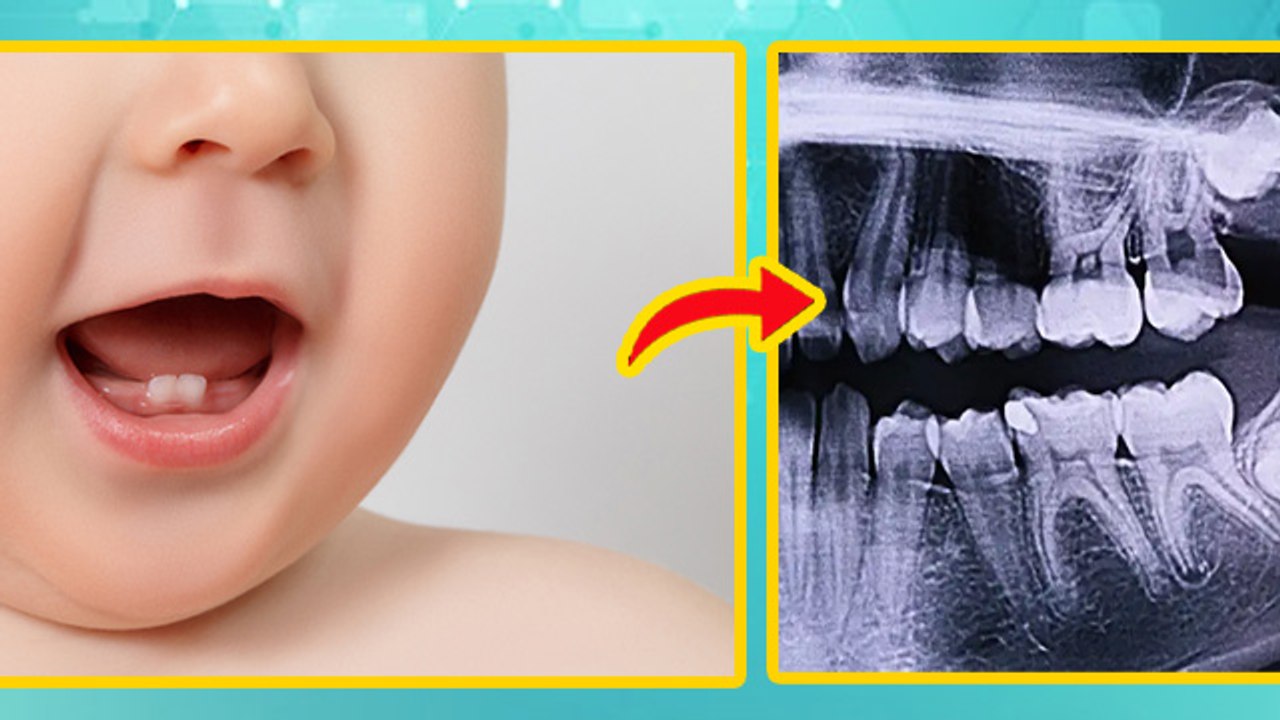 Delay In Tooth Eruption Baby: बच्चों के दांत देरी से क्यों आते है, Baccho Ke Dant Late Kyu Aate Hai