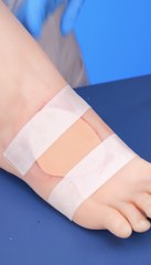 The Hidden World of Body Surgery: Medical Secrets Revealed