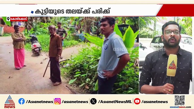 മദ്രസയിലേക്ക് പോയ ആറ് വയസുകാരന് തെരുവുനായയുടെ കടിയേറ്റു; കുട്ടിയുടെ തലയ്ക്ക് പരിക്ക്
