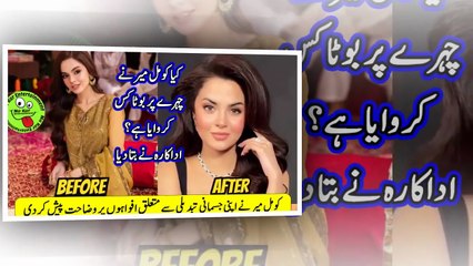Komal Meer ne bhi Botox karwa liya ? کیا کومل میر نے چہرے پر بوٹاکس کروایا ہے؟ اداکارہ نے بتا دیا