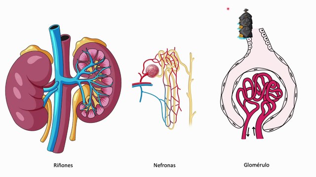 ¿Por qué la diabetes mal controlada daña los riñones? #elcuerpoymas #medicina #salud #diabetes