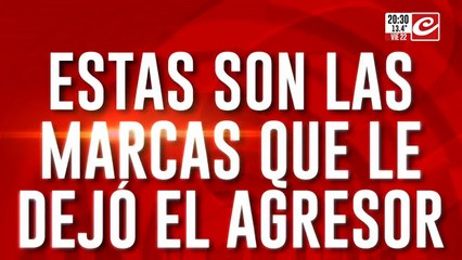 Estas son las marcas que dejo el agresor