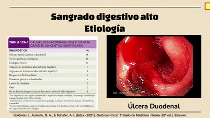 Sangrado Digestivo Alto #elcuerpoymas #medicina #salud #sangradodigestivo