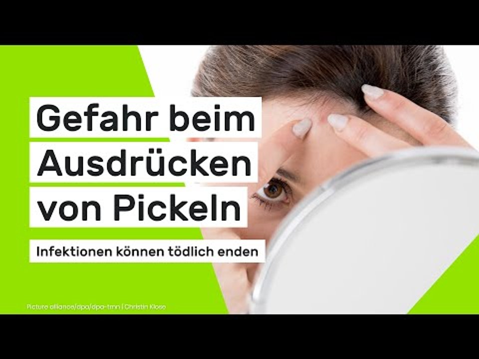 Infektion nach Ausdrücken von Pickeln kann tödlich enden