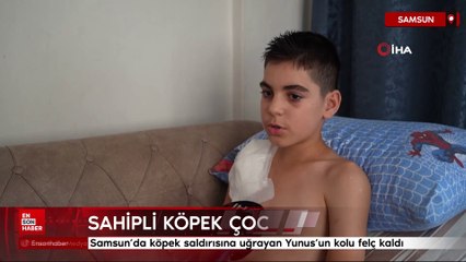 Samsun’da köpek saldırısına uğrayan Yunus’un kolu felç kaldı