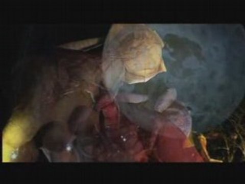 PLASTICIENS VOLANTS pecheurs de lune