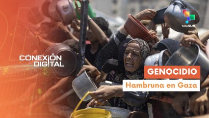 Conexión digital 21-08 Desnutrición en Gaza deja víctimas mortales