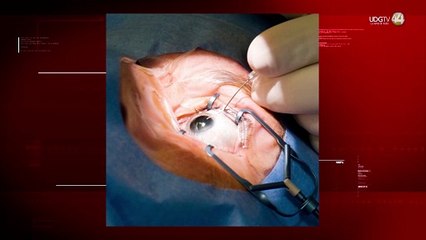 Proteger los ojos reduce a la mitad las lesiones que pueden llevar a la ceguera