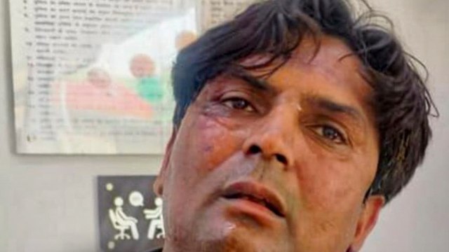 CM Rekha Gupta पर हमले के मामले में मिला बड़ा सुराग!