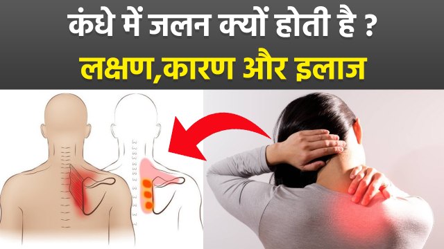 कंधे में जलन क्यों होती है,लक्षण,कारण,इलाज | Kandhe Me Jalan Hone Ka Karan | Boldsky