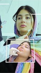 تزریق ژل چانه برای اصلاح فرم چانه