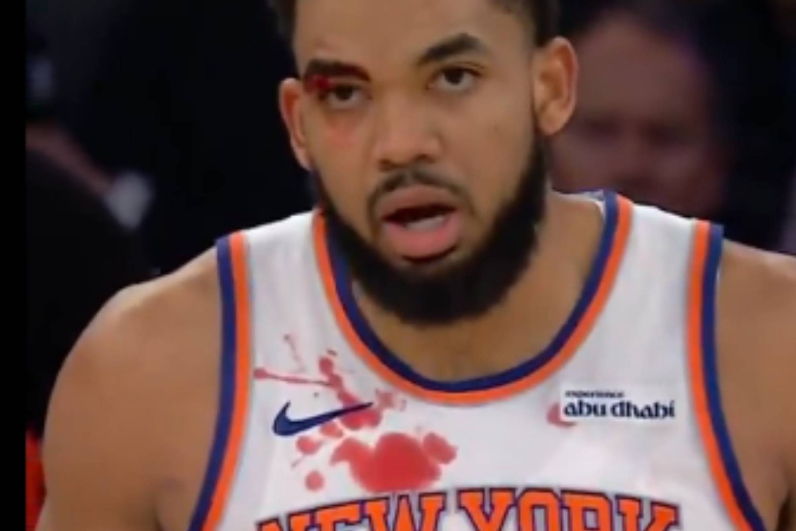 Corre la sangre en la NBA a la espera del posible traspaso y destino de Antetokounmpo